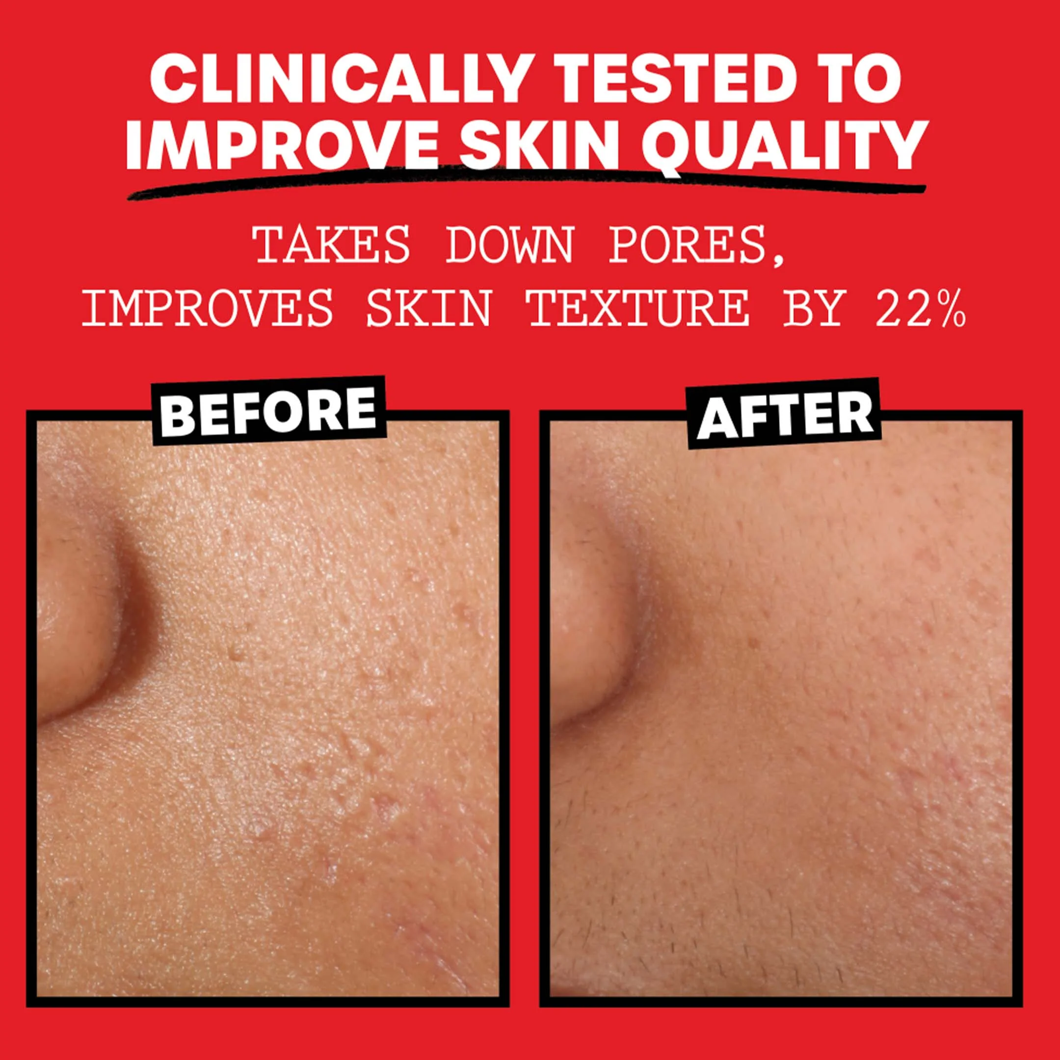 Alcohol Free Witch Hazel Toner Rose - Image 37