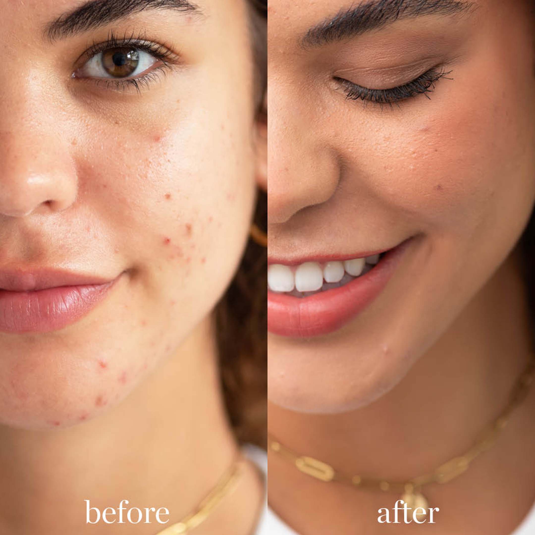 Arnica Concealer - Image 2