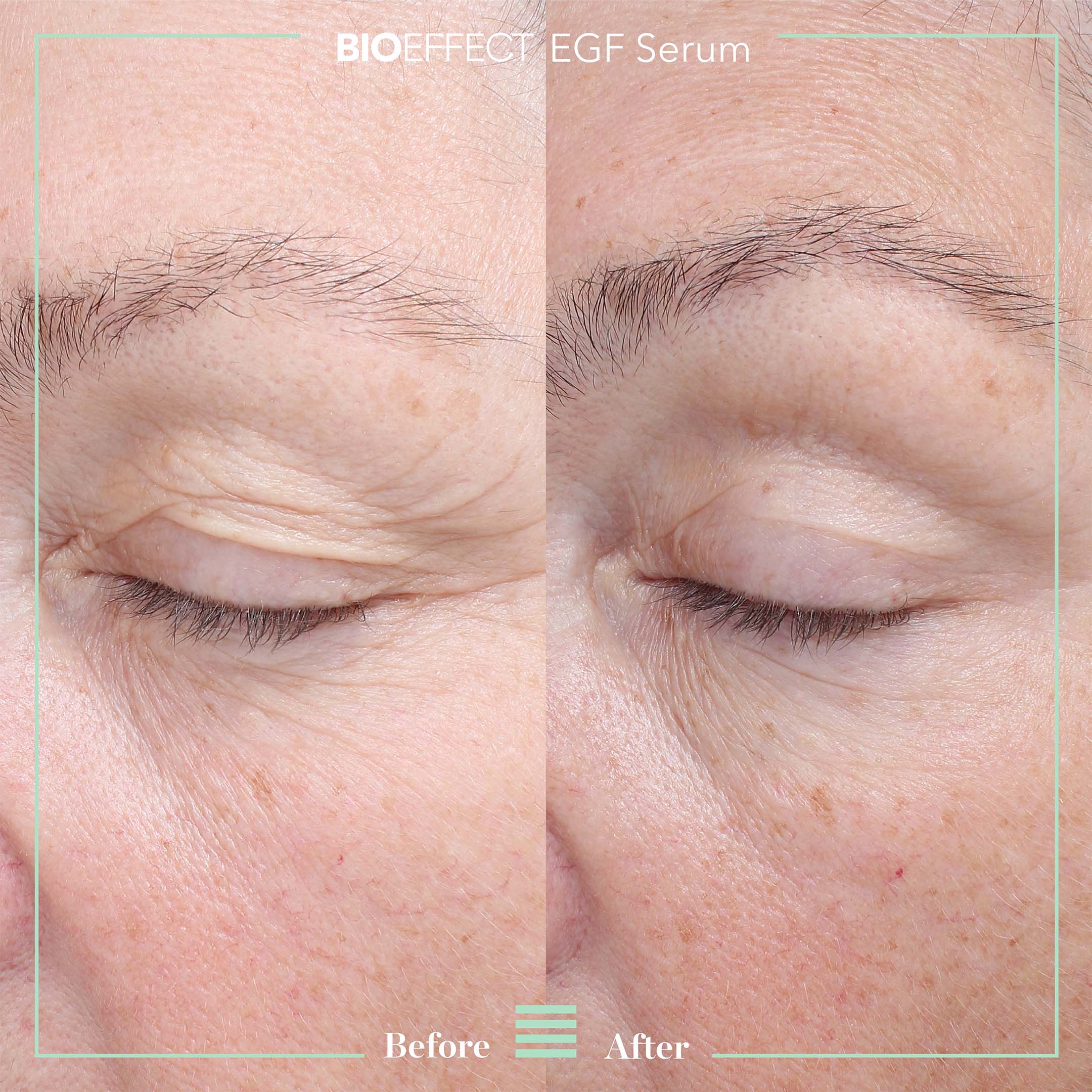 EGF SERUM (15ml) - Image 3