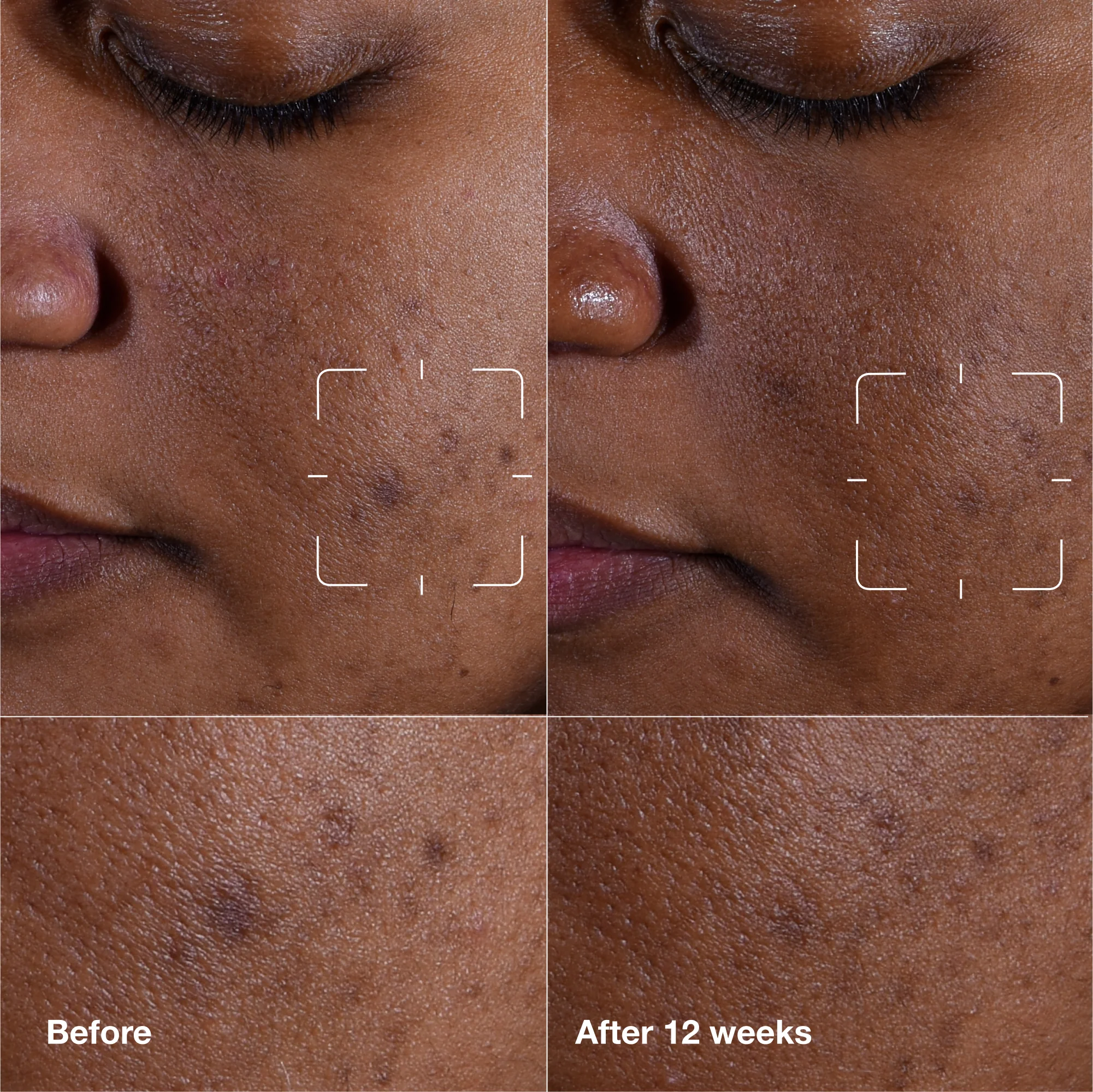 Even Better Clinical™ Dark Spot Clearing Serum with Vitamin C - Image 10