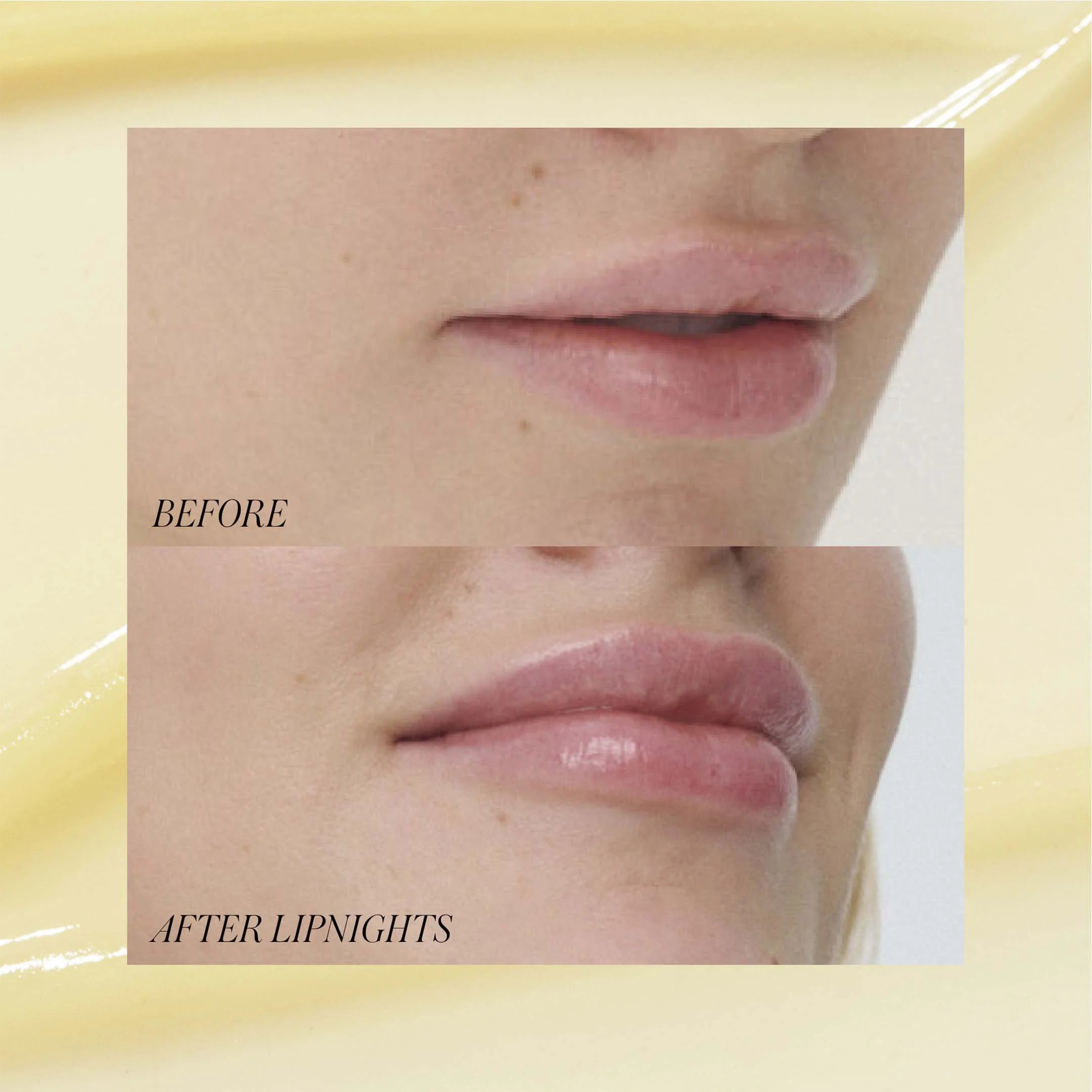 Lipnights Overnight Lip Mask - Image 3