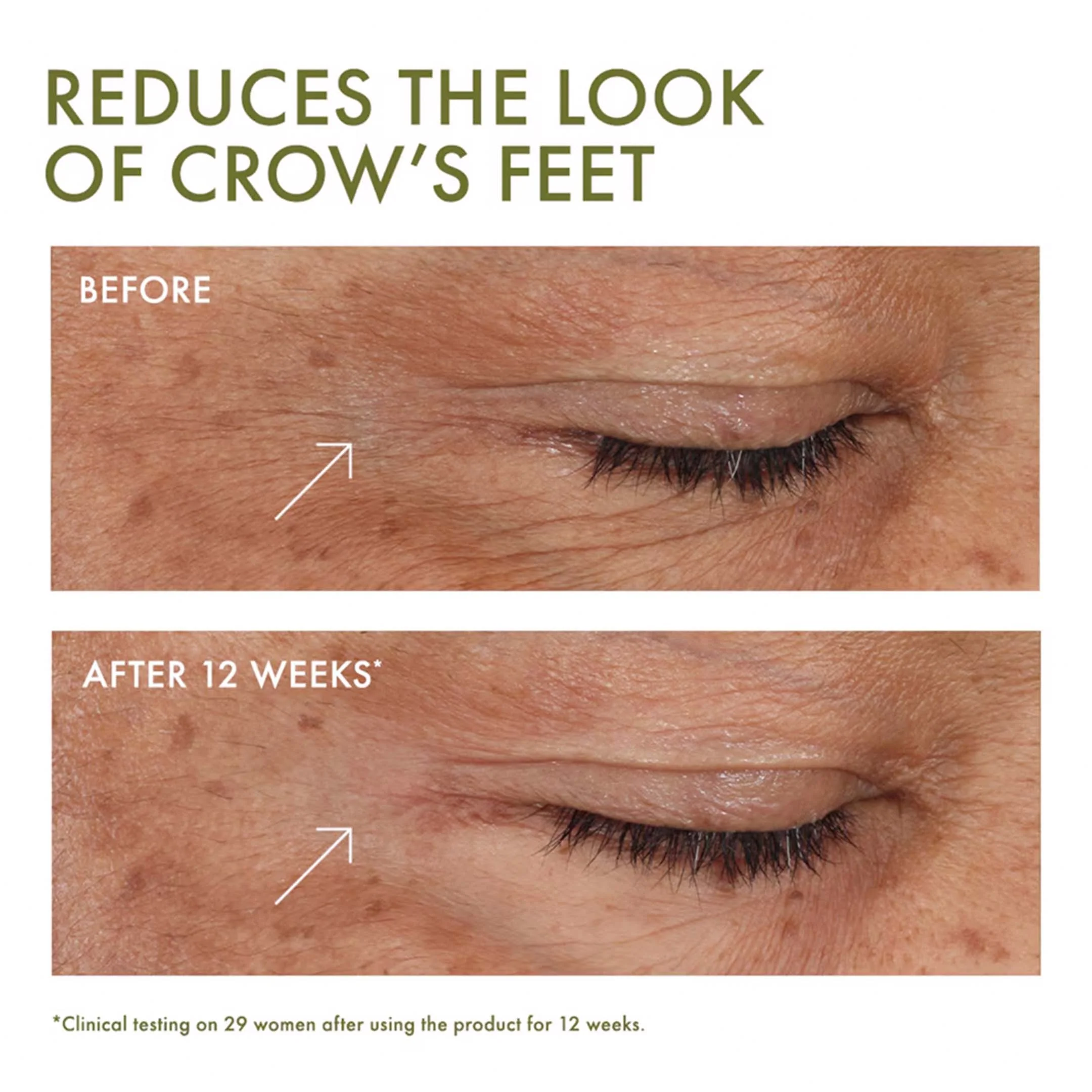 Plantscription™ Wrinkle Correction Eye Cream With Encapsulated Retinol - Image 4