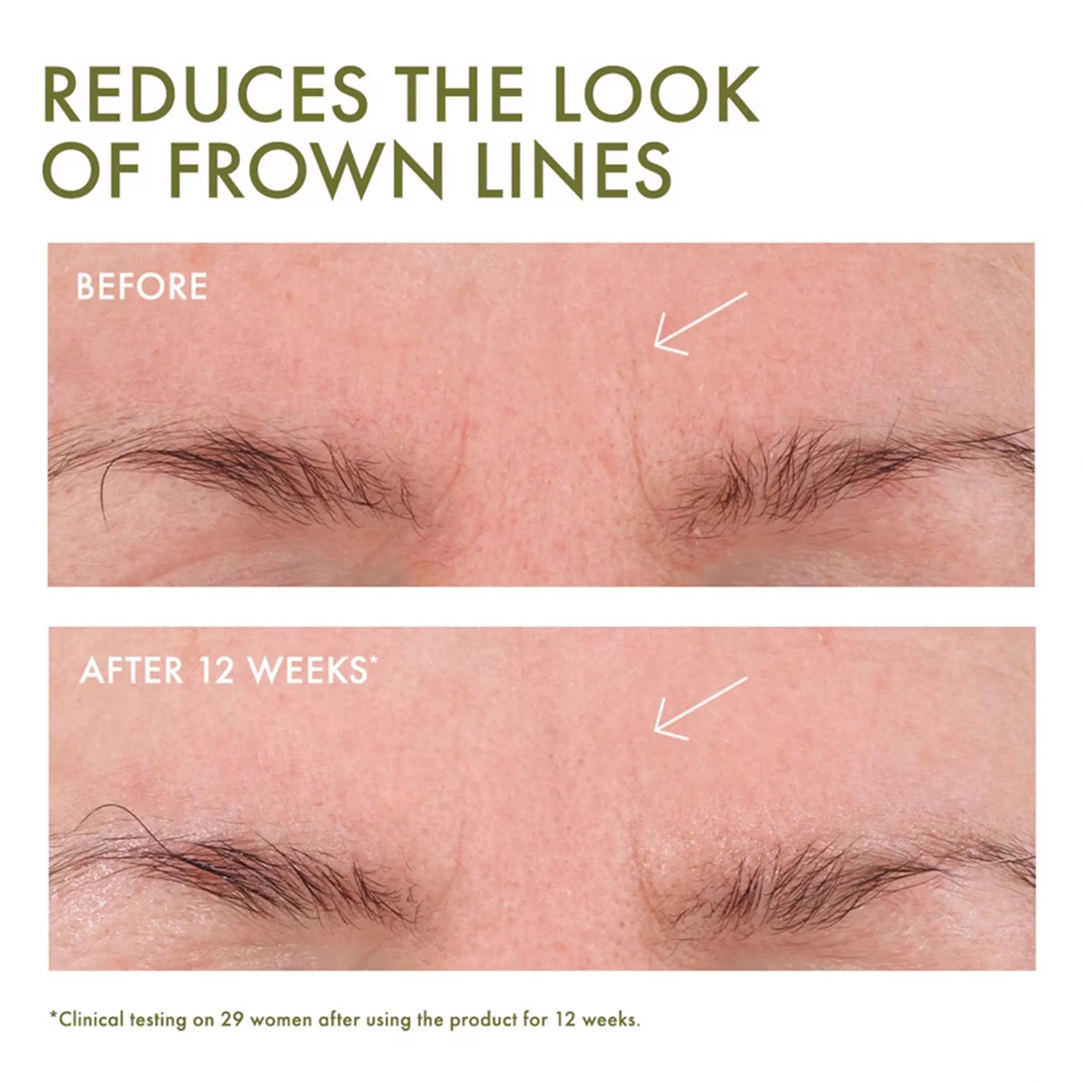 Plantscription™ Wrinkle Correction Eye Cream With Encapsulated Retinol - Image 5