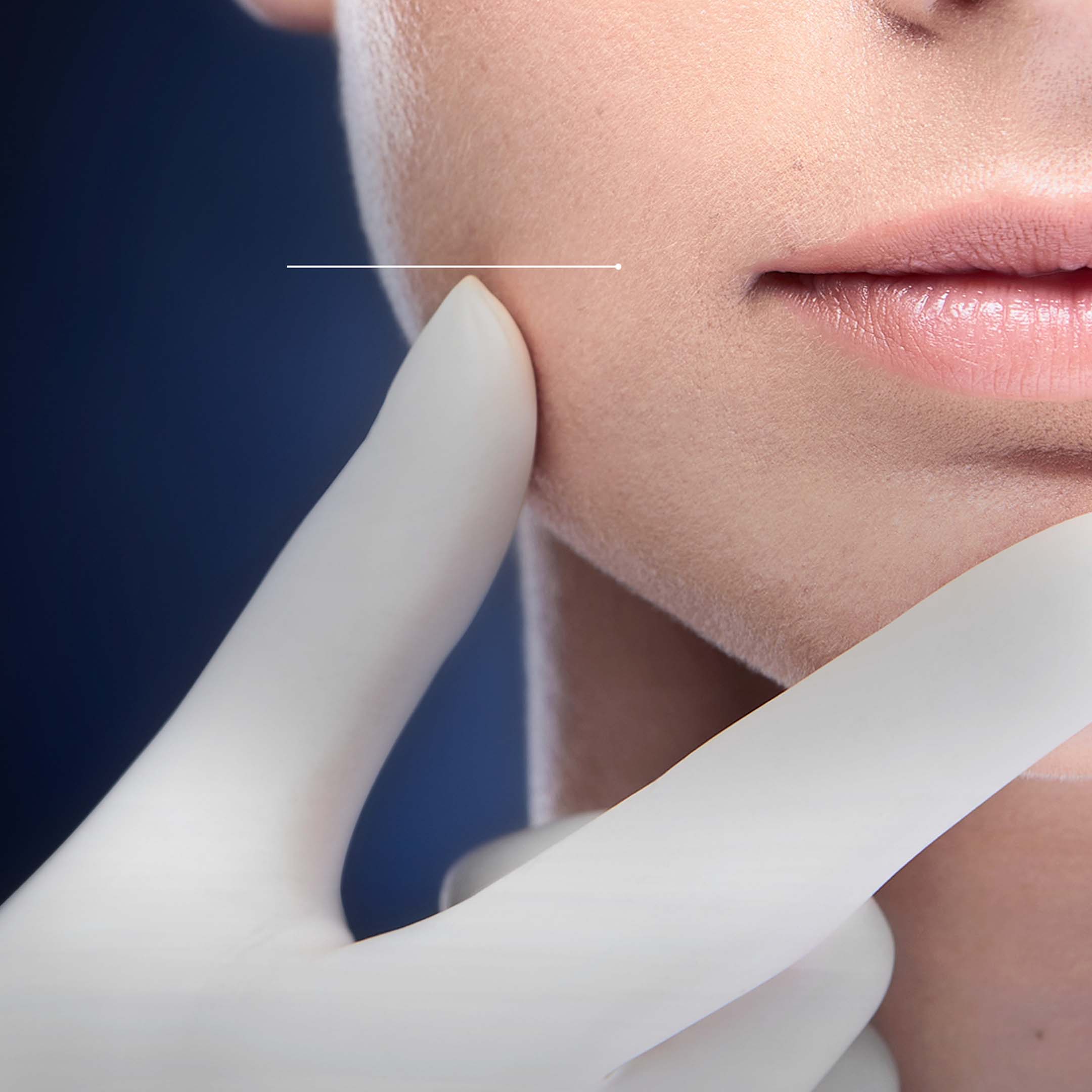 SLEEP & PEEL 4.5 - Image 4