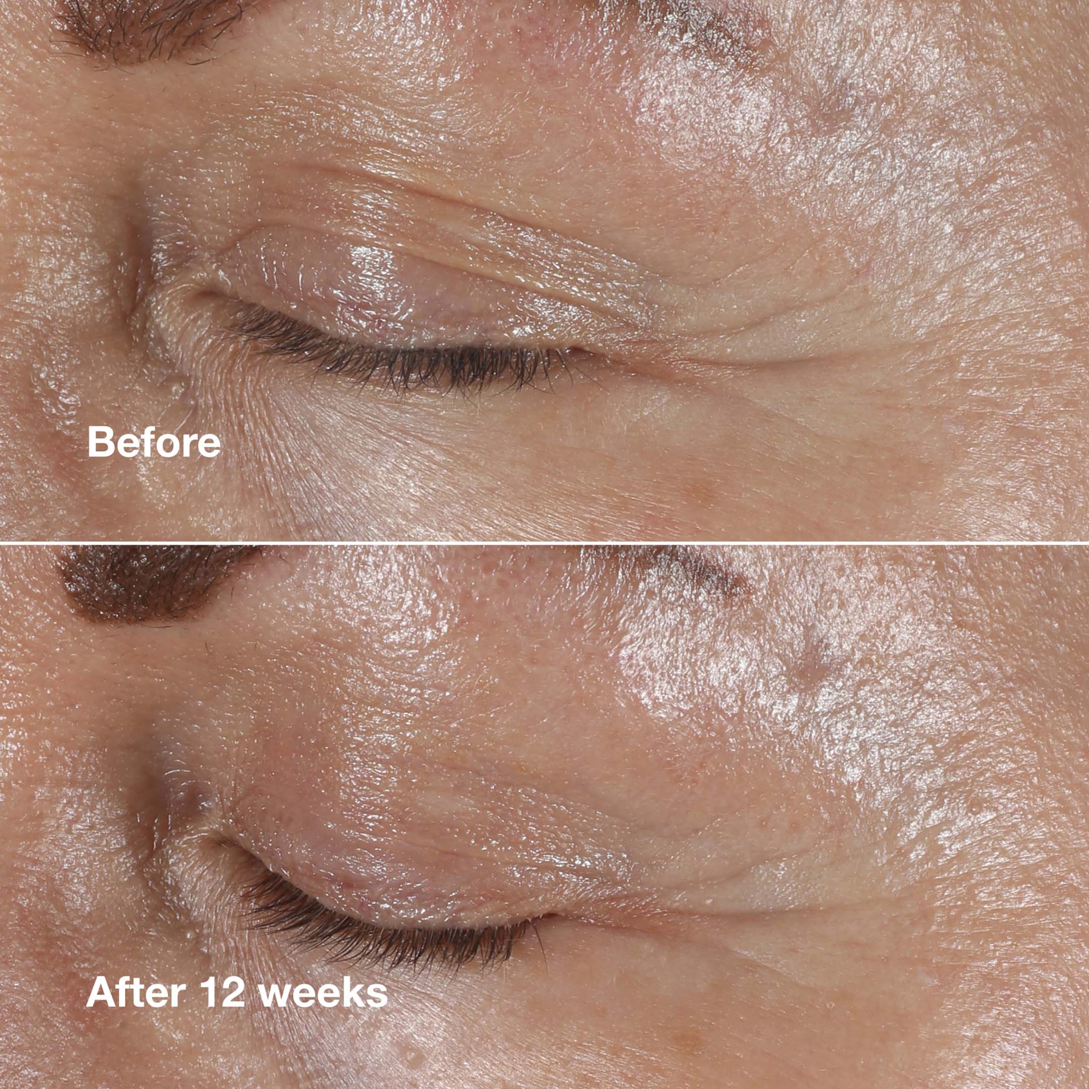 Smart Clinical Repair™  Wrinkle Correcting Eye Cream - Image 2