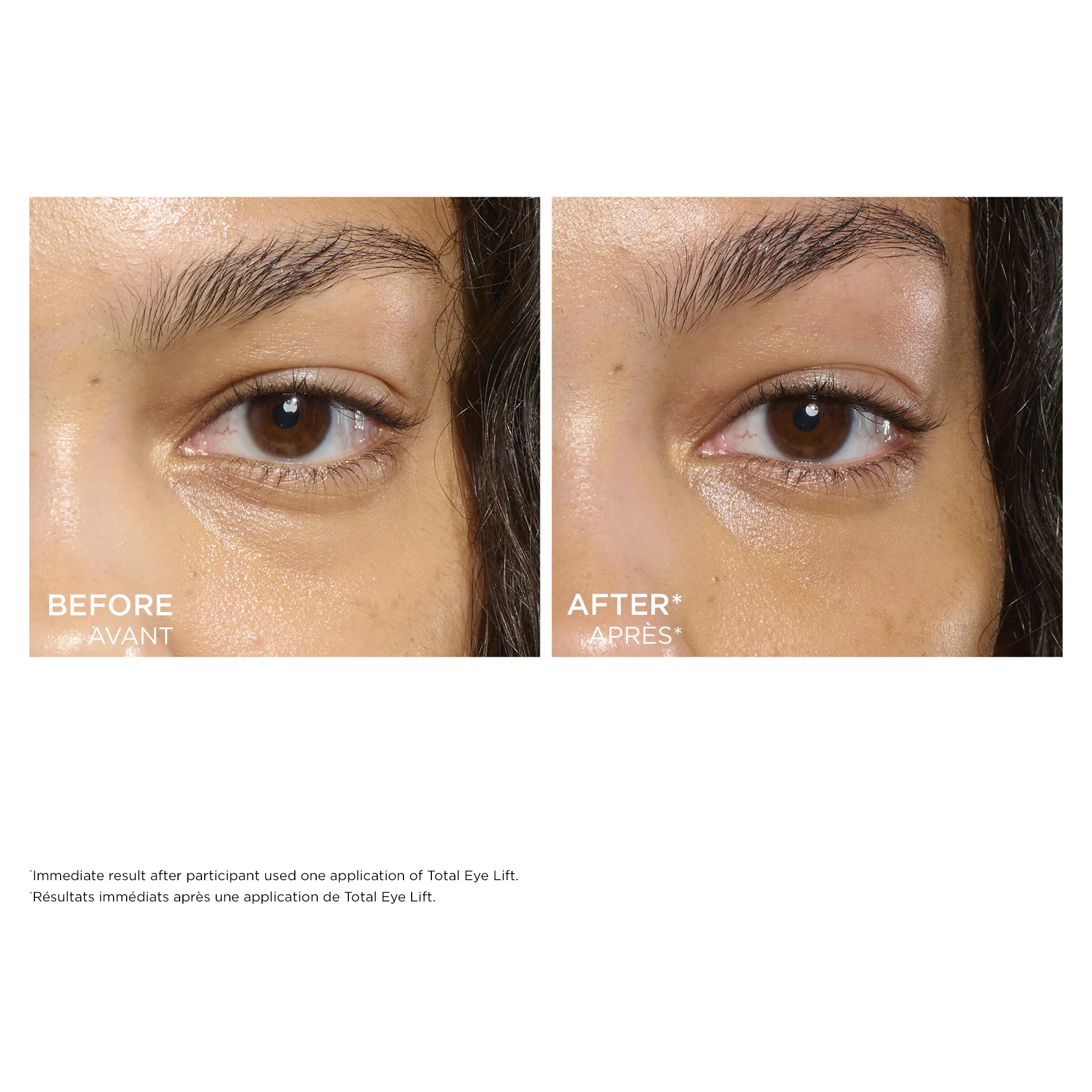Total Eye Lift - Image 3